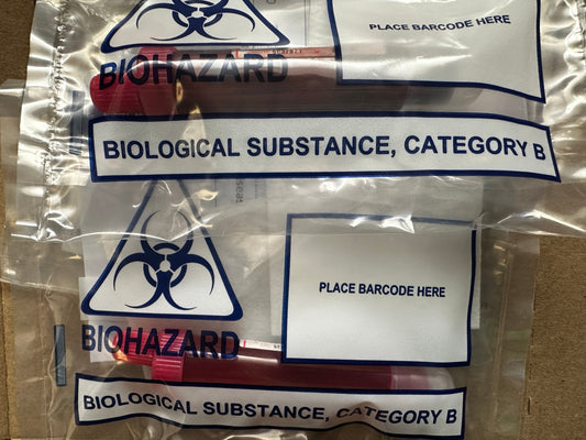 More Than Deer: Why We’re Supporting UKHSA Research